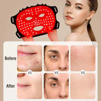 7-Colour LED Light Therapy Mask